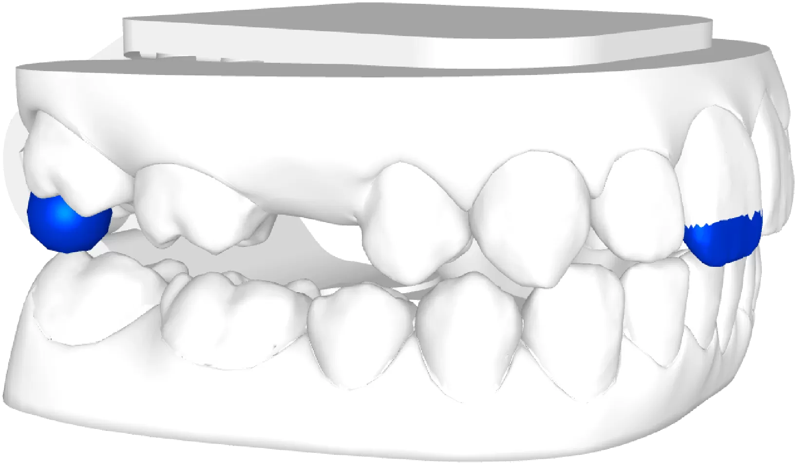 Dentado